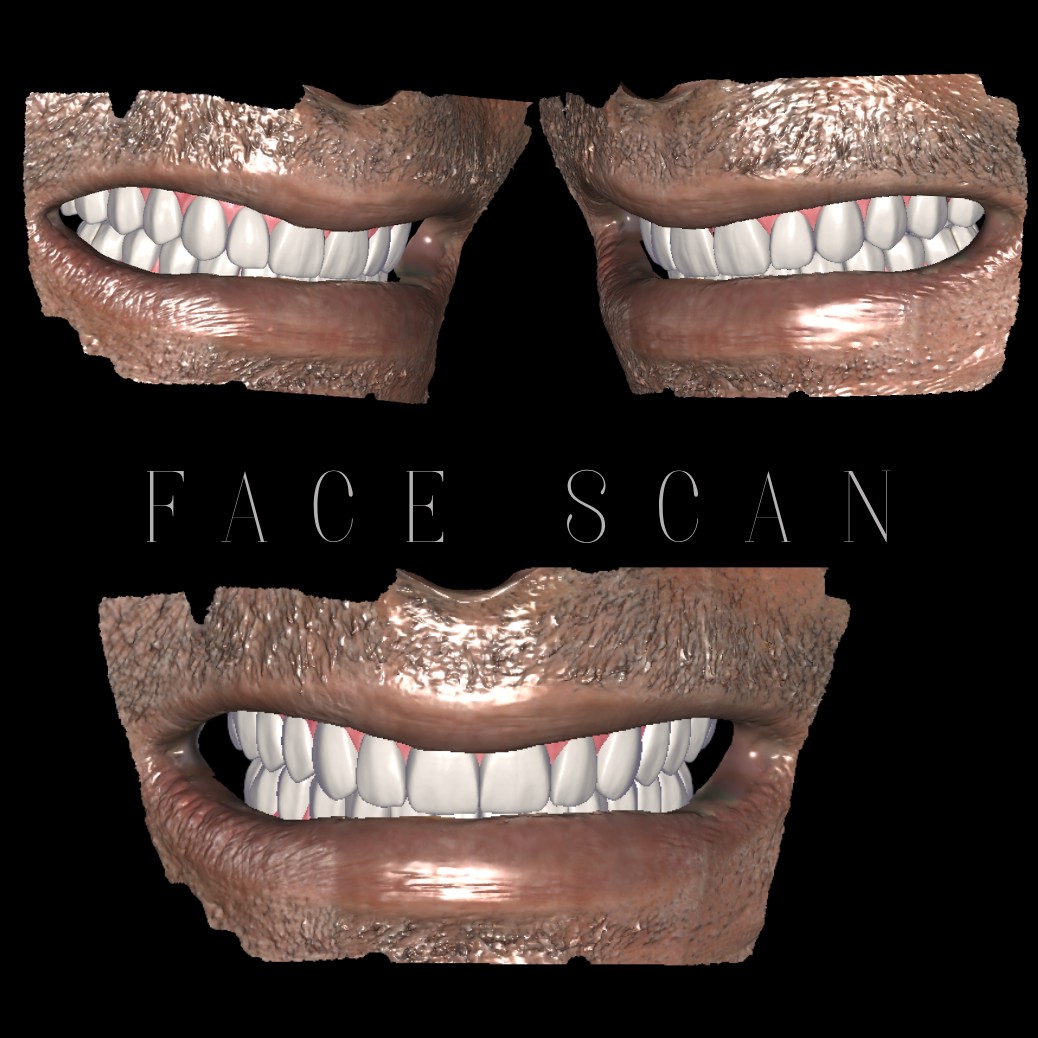 PROTOCOLO DUPLO + FACESCAN