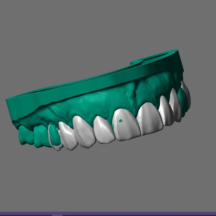 Planejamento 3D