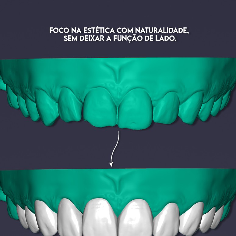 Planejamento digital para lentes