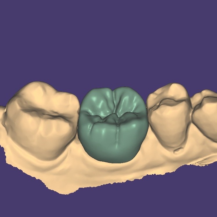Coroa