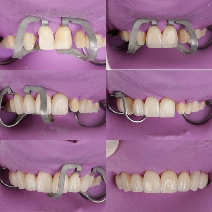 Trabalho de Rodrigo Pacheco na Bypflow