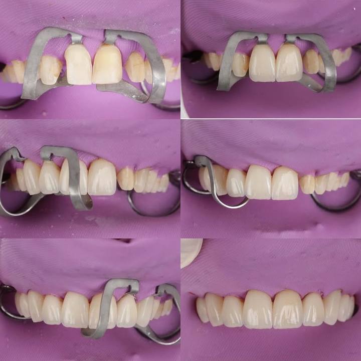 Trabalho de Rodrigo Pacheco na Bypflow