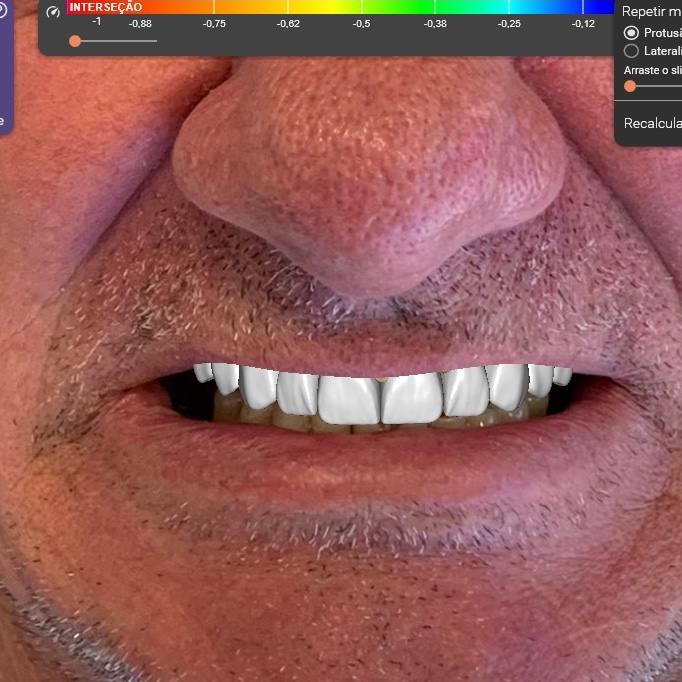 Trabalho de Lizi Albuquerque na Bypflow
