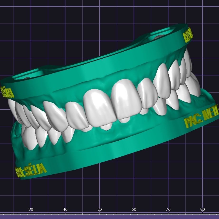 Trabalho de Lizi Albuquerque na Bypflow