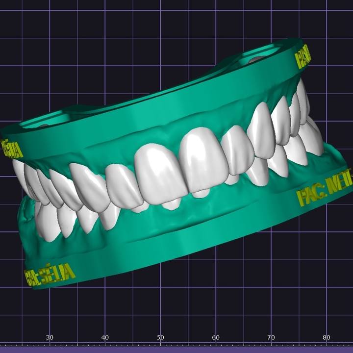 Trabalho de Lizi Albuquerque na Bypflow