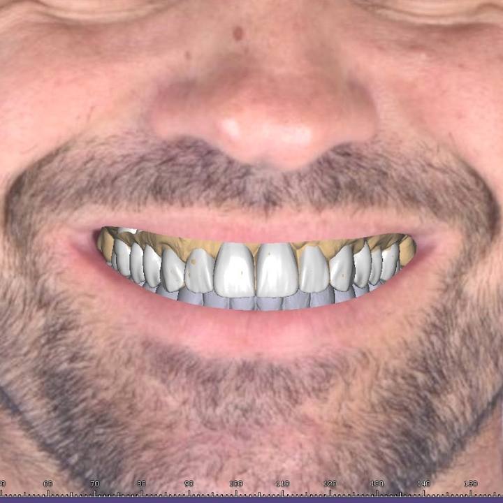 Trabalho de Pedro Henrique na Bypflow