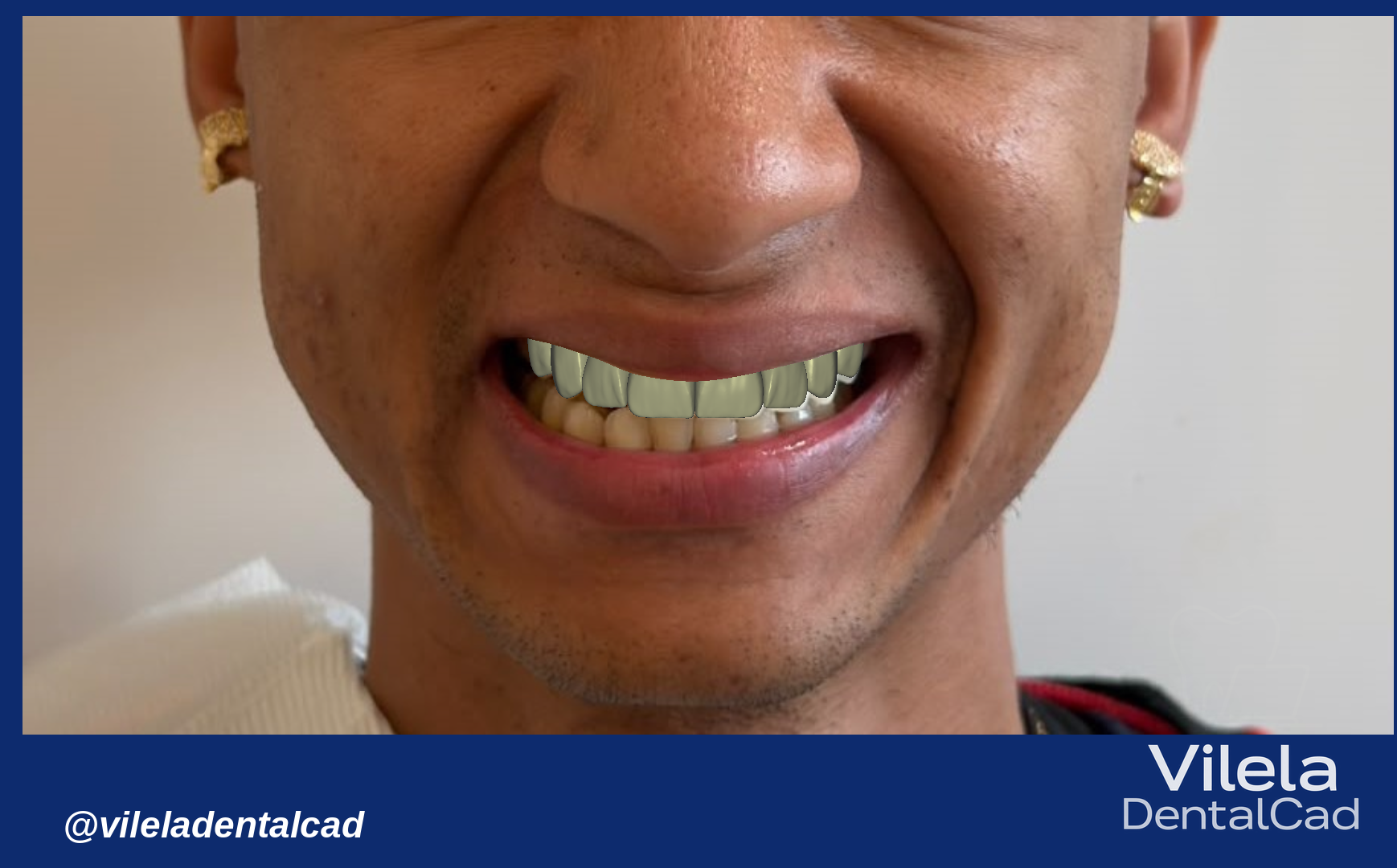 Trabalho de João Vilela na Bypflow