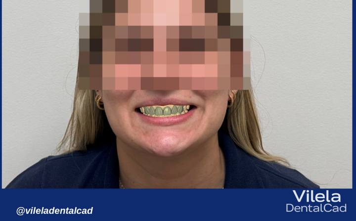 Trabalho de João Vilela na Bypflow