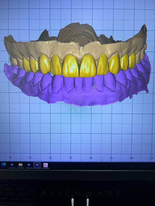 Trabalho de Pedro Henrique na Bypflow